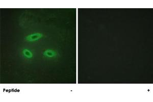 Immunofluorescence analysis of HeLa cells, using NKTR polyclonal antibody . (NKTR Antikörper)