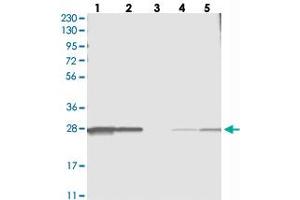Western blot analysis of Lane 1: RT-4, Lane 2: U-251 MG, Lane 3: Human Plasma, Lane 4: Liver, Lane 5: Tonsil with C11orf73 polyclonal antibody  at 1:250-1:500 dilution.