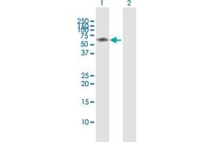 Western Blot analysis of IRAK3 expression in transfected 293T cell line by IRAK3 MaxPab polyclonal antibody. (IRAK3 Antikörper  (AA 1-596))
