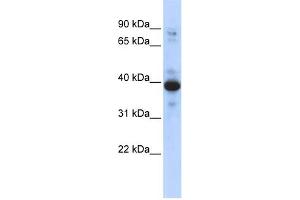 WB Suggested Anti-RNF34 Antibody Titration:  0. (RNF34 Antikörper  (Middle Region))