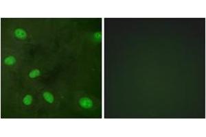 Immunofluorescence analysis of HeLa cells, using GIRK1/KIR3. (KCNJ3 Antikörper  (pSer185))