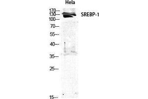 Western Blotting (WB) image for anti-Sterol Regulatory Element Binding Transcription Factor 1 (SREBF1) (Tyr1175) antibody (ABIN3177512) (SREBF1 Antikörper  (Tyr1175))