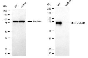 Western blotting analysis using GOLM1 antibody (ABIN7798792).