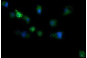 Image no. 1 for anti-RIO Kinase 2 (RIOK2) (AA 277-552) antibody (ABIN1491305) (RIOK2 Antikörper  (AA 277-552))