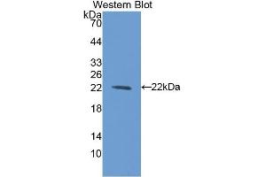 Western Blotting (WB) image for anti-Bleomycin Hydrolase (BLMH) (AA 30-165) antibody (ABIN1175602) (BLMH Antikörper  (AA 30-165))