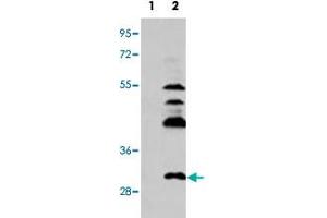 Western blot analysis of UCK2 (arrow) using UCK2 polyclonal antibody . (UCK2 Antikörper  (C-Term))