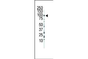 Western blot analysis of anti-FGFR3 Pab (ABIN391969 and ABIN2841765) in Jurkat cell lysate. (FGFR3 Antikörper  (C-Term))