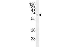 MAPK15 antibody western blot analysis in MCF-7 lysate. (MAPK15 Antikörper)