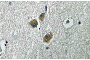 Immunohistochemistry (IHC) analyzes of ME3 antibody in paraffin-embedded human brain tissue.