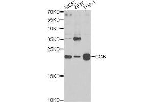 Western blot analysis of extracts of various cell lines, using CGB Antibody. (Chorionic Gonadotropin, beta Polypeptide 3 (CGB3) Antikörper)