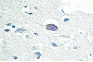 Image no. 2 for anti-Interleukin-1 Receptor-Associated Kinase 3 (IRAK3) antibody (ABIN317722)