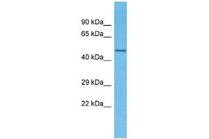 Host: Rabbit Target Name: TMEM194A Sample Type: Fetal Kidney lysates Antibody Dilution: 1. (TMEM194A Antikörper  (N-Term))