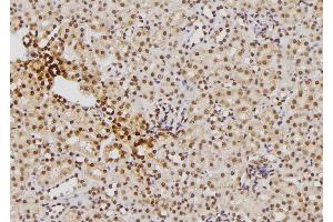 ABIN6276386 at 1/100 staining Mouse kidney tissue by IHC-P. (S100B Antikörper  (C-Term))