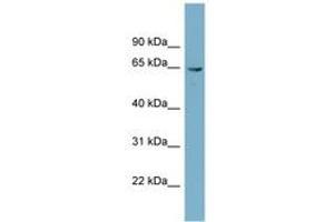 Image no. 1 for anti-Phosphoglucomutase 3 (PGM3) (AA 107-156) antibody (ABIN6741932) (Phosphoglucomutase 3 Antikörper  (AA 107-156))