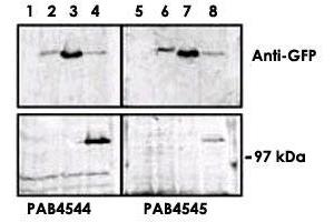 Upper panel, western blot analysis of GFP fusion protein expression in Panc-1 cells by using an PRKD3 polyclonal antibody  . (PRKD3 Antikörper  (C-Term))