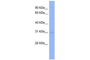 Claudin 18 antibody used at 1 ug/ml to detect target protein. (Claudin 18 Antikörper  (Middle Region))