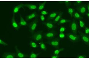 Immunofluorescence analysis of A549 cells using APTX Polyclonal Antibody (Aprataxin Antikörper)