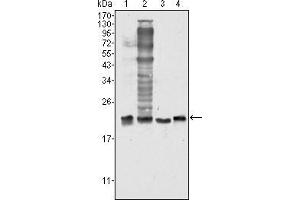Western blot analysis using SOD1 mouse mAb against Hela (1), NIH/3T3 (2), A549 (3) and A431 (4) cell lysate. (SOD1 Antikörper)