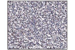 IHC analysis of FABP-1/GOT2 using anti-FABP-1/GOT2 antibody (ABIN7601426). (GOT2 Antikörper  (AA 35-430))