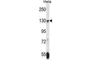 TNKS Antibody (N-term) western blot analysis in Hela cell line lysates (35 µg/lane). (TNKS Antikörper  (N-Term))