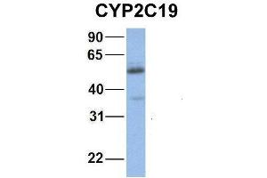 Host:  Rabbit  Target Name:  NOP56  Sample Type:  Human Fetal Muscle  Antibody Dilution:  1. (CYP2C19 Antikörper  (Middle Region))