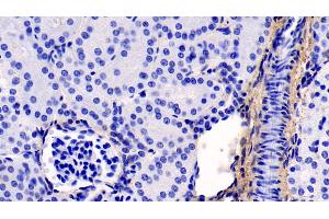 Immunohistochemistry (IHC) image for anti-Collagen, Type I, alpha 1 (COL1A1) (AA 253-471) antibody (ABIN7428014)