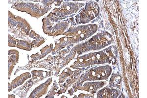 IHC-P Image RRM2 antibody [N1C1] detects RRM2 protein at cytoplasm on mouse intestine by immunohistochemical analysis. (RRM2 Antikörper  (Regulatory Subunit))