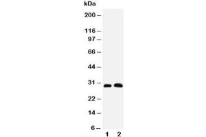 Western blot testing of Aquaporin 5 antibody and Lane 1:  rat lung (Aquaporin 5 Antikörper  (C-Term))