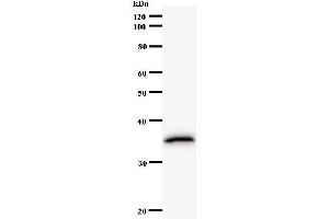 Western Blotting (WB) image for anti-Translin-Associated Factor X (TSNAX) antibody (ABIN932466) (TSNAX Antikörper)