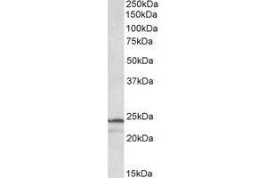 Western Blotting (WB) image for anti-Proteasome Subunit beta 3 (PSMB3) (Internal Region) antibody (ABIN2464725) (PSMB3 Antikörper  (Internal Region))