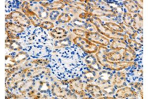 ABIN6262943 and ABIN6277882 at 1/100 staining Rat kidney tissue by IHC-P. (LDLR Antikörper  (Internal Region))