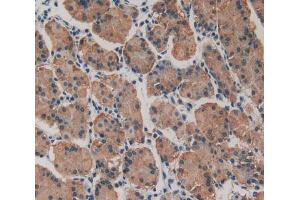 Used in DAB staining on fromalin fixed paraffin- embedded stomach tissue (MYH10 Antikörper  (AA 438-716))