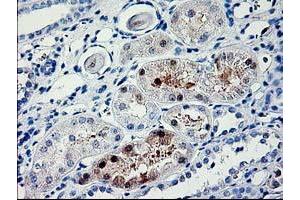 Immunohistochemical staining of paraffin-embedded Human Kidney tissue using anti-PDE6G mouse monoclonal antibody. (PDE6G Antikörper)