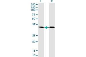 Western Blot analysis of DLX6 expression in transfected 293T cell line by DLX6 monoclonal antibody (M06), clone 2D7. (DLX6 Antikörper  (AA 71-160))