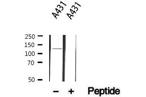 Western blot analysis of extracts from A431, using ITGA6 Antibody. (ITGA6 Antikörper  (N-Term))