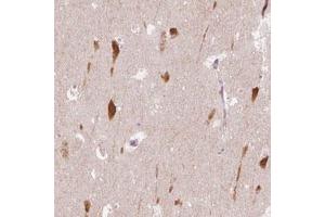 Immunohistochemical staining (Formalin-fixed paraffin-embedded sections) of human hippocampus with SCG3 polyclonal antibody  shows cytoplasmic positivity in neurons. (SCG3 Antikörper)