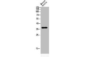 Western blot analysis of MOUSE-BRAIN lysis using ART1 antibody. (ART1 Antikörper  (Internal Region))