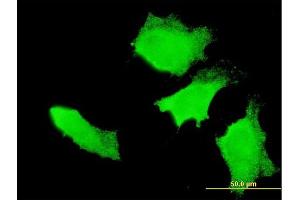 Immunofluorescence of monoclonal antibody to APC on HeLa cell. (APC Antikörper  (AA 2744-2843))