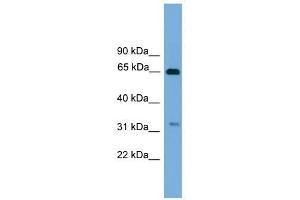 UBXD3 antibody used at 1 ug/ml to detect target protein. (UBXN10 Antikörper  (Middle Region))