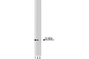 Western blot analysis of Bid on a Jurkat cell lysate (Human T-cell leukemia, ATCC TIB-152). (BID Antikörper  (AA 50-62))