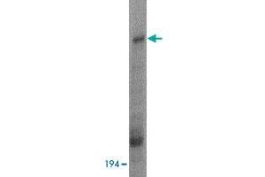 Western blot analysis of HUWE1 in Daudi cell lysate with HUWE1 polyclonal antibody  at 1 ug/mL . (HUWE1 Antikörper  (C-Term))