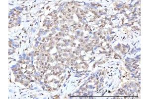 IHC analysis of RANBP2 using anti-RANBP2 antibody (ABIN7602650). (RANBP2 Antikörper  (AA 906-2744))