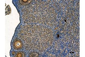 ABIN6265178 and ABIN6268693 at 1/100 staining Mouse ovary tissue by IHC-P.