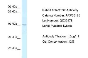 Western Blotting (WB) image for anti-Cathepsin E (CTSE) (C-Term) antibody (ABIN2788343) (Cathepsin E Antikörper  (C-Term))