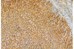 ABIN6263284 and ABIN6272925 at 1/100 staining Rat stomach tissue by IHC-P. (MLYCD Antikörper  (Internal Region))