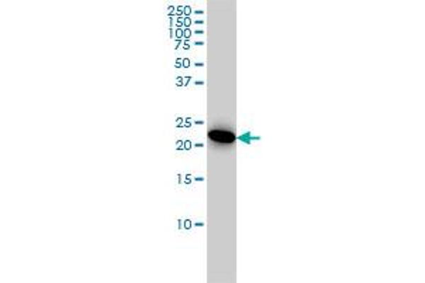 Adenylate Kinase 1 Antikörper  (AA 1-194)