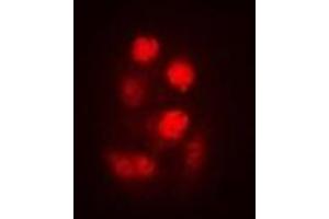Immunofluorescent analysis of SEN2 staining in A549 cells. (TSEN2 Antikörper)