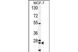 NUDT8 Antibody (N-term) (ABIN654517 and ABIN2844241) western blot analysis in MCF-7 cell line lysates (35 μg/lane). (NUDT8 Antikörper  (N-Term))