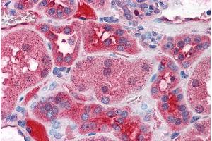 ABIN571061 (3. (KCNN2 Antikörper  (Internal Region))