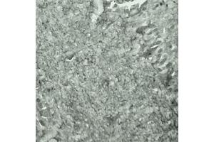 IHC on mouse brain (cryo section) using Rabbit antibody to Synaptotagmin 17  at a concentration of 50 µg/ml incubated overnight at 4C. (SYT17 Antikörper  (Internal Region))